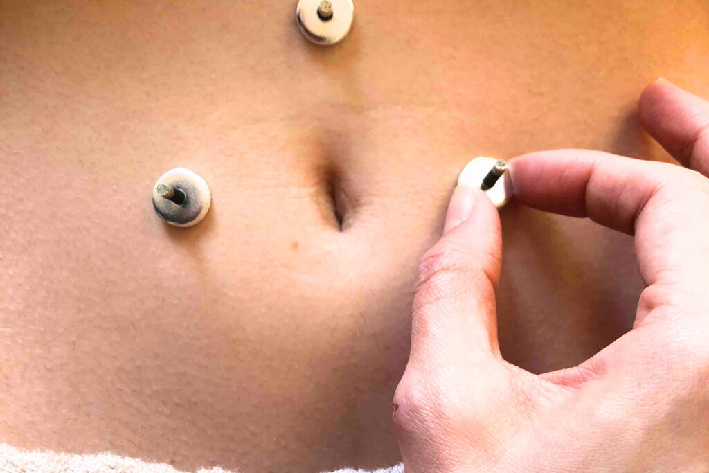 女性のおへその周りにお灸,台座級